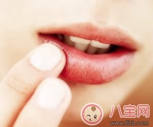 哺乳期上火还能喂奶吗 如何预防奶水上火呢 哺乳期上火还能喂奶吗 如何预防奶水上火呢(图3)