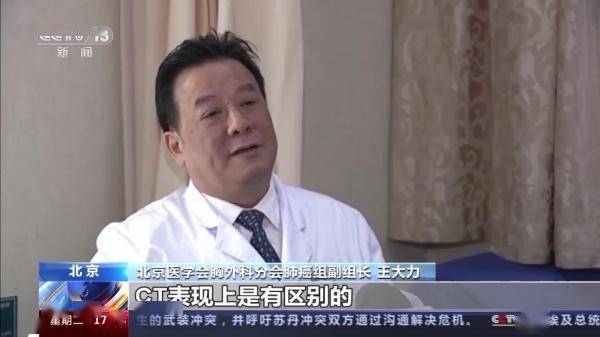 如何预防“沉默的”癌症?早筛查、早诊断是关键 (图2) 如何预防“沉默的”癌症?早筛查、早诊断是关键 (图2)