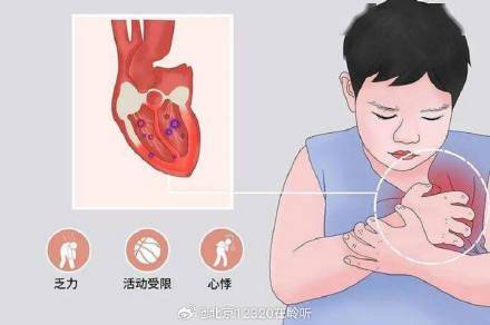 儿童得了心肌炎有什么表现? (图1) 儿童得了心肌炎有什么表现? (图1)
